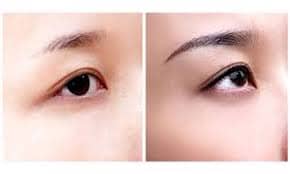 Eyebrow embroidery